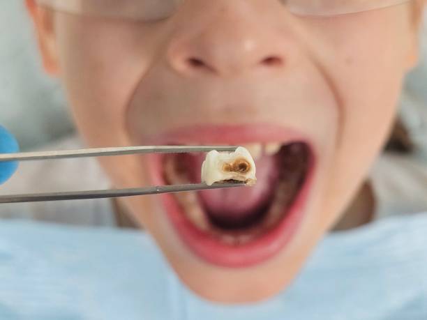 Best Emergency Dentist for Special Needs Patients in Forest Meadows, CA