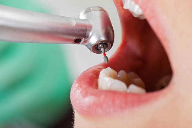 Best Urgent Dental Care for Toothache in Forest Meadows, CA